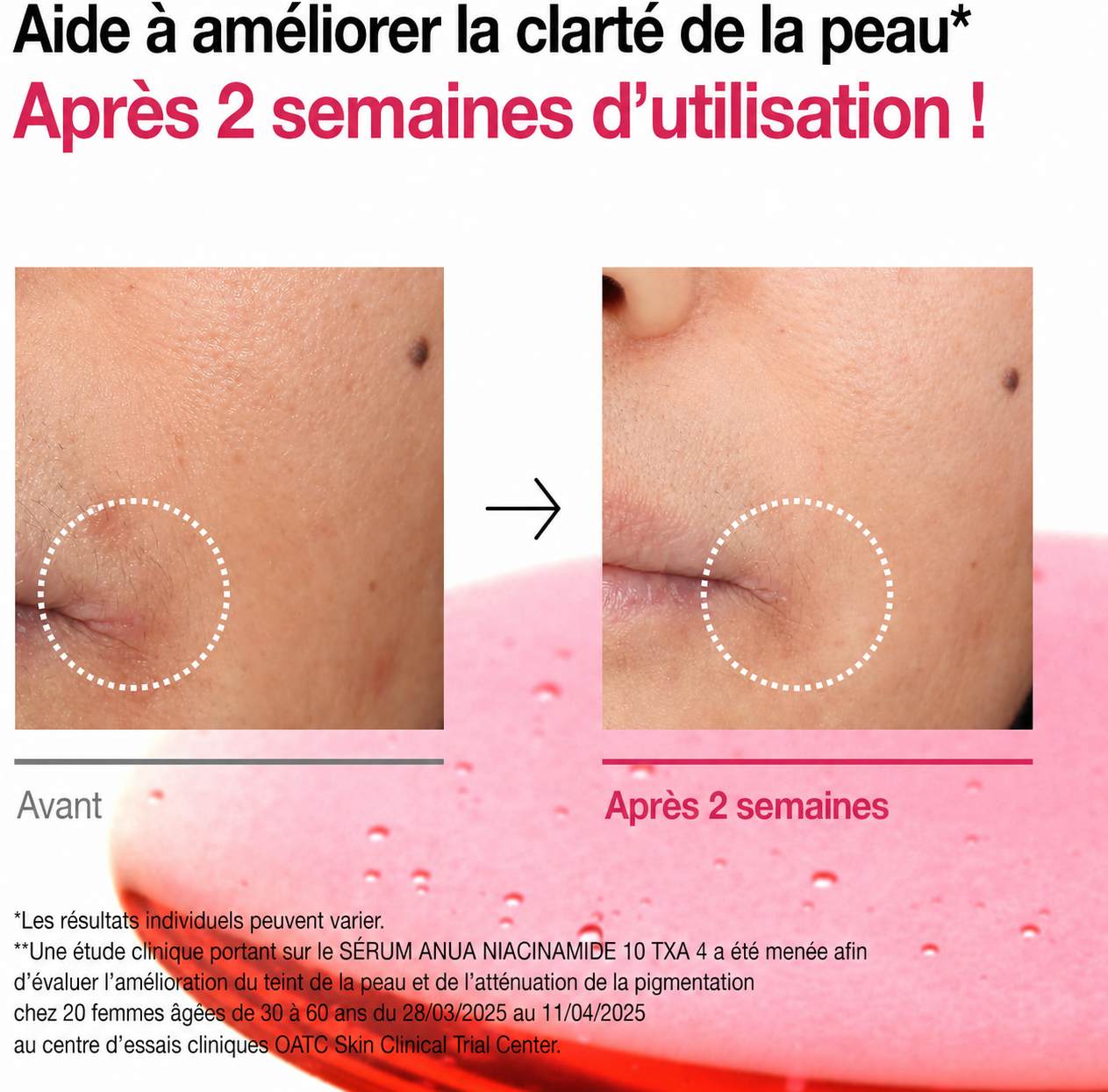 Sérum Anti-Taches ANUA Niacinamide 10% + TXA 4% – Triple Action Éclat & Teint Unifié