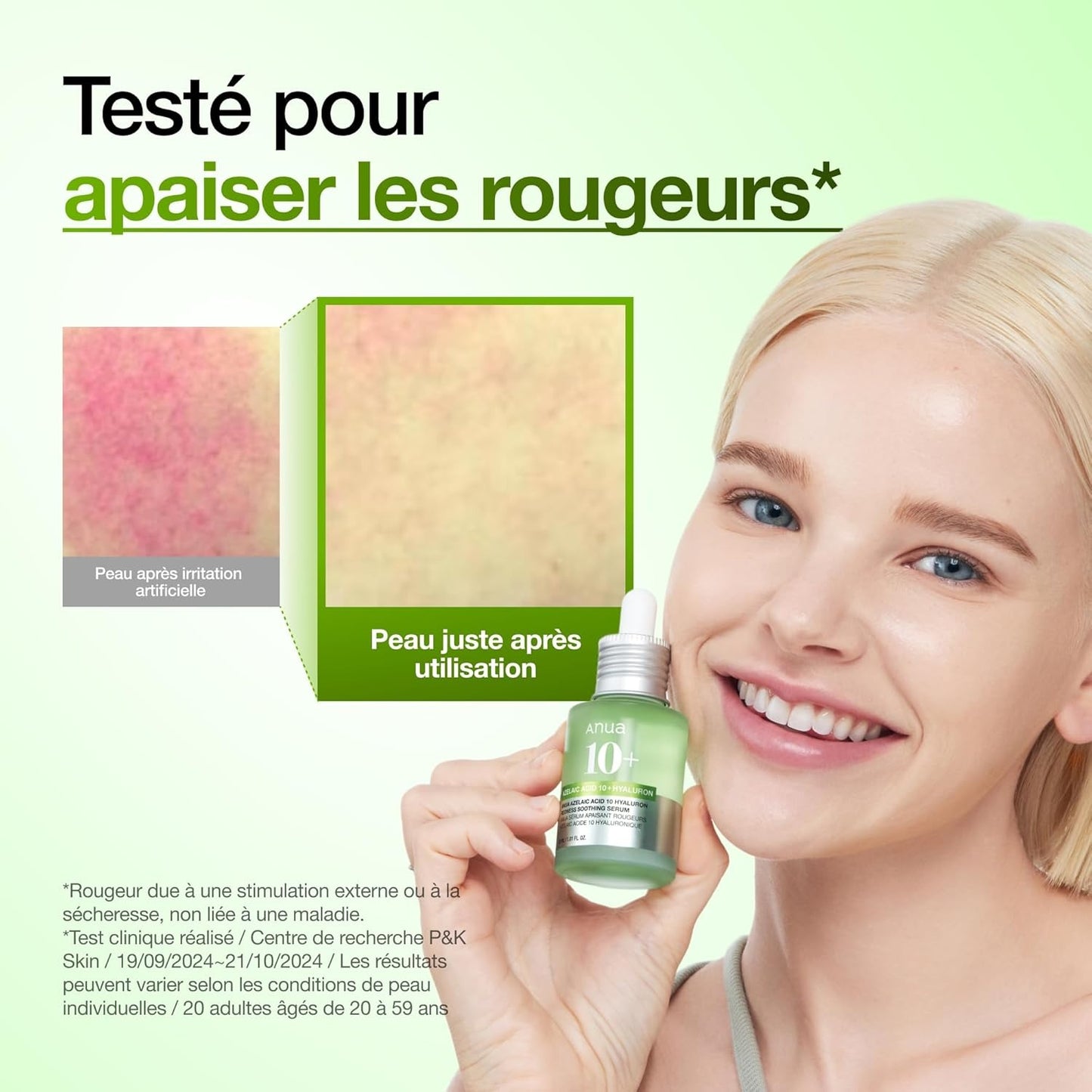 Sérum Apaisant ANUA Acide Azélaïque 10% + Hyaluron – Rougeurs, Acné & Peau Nette