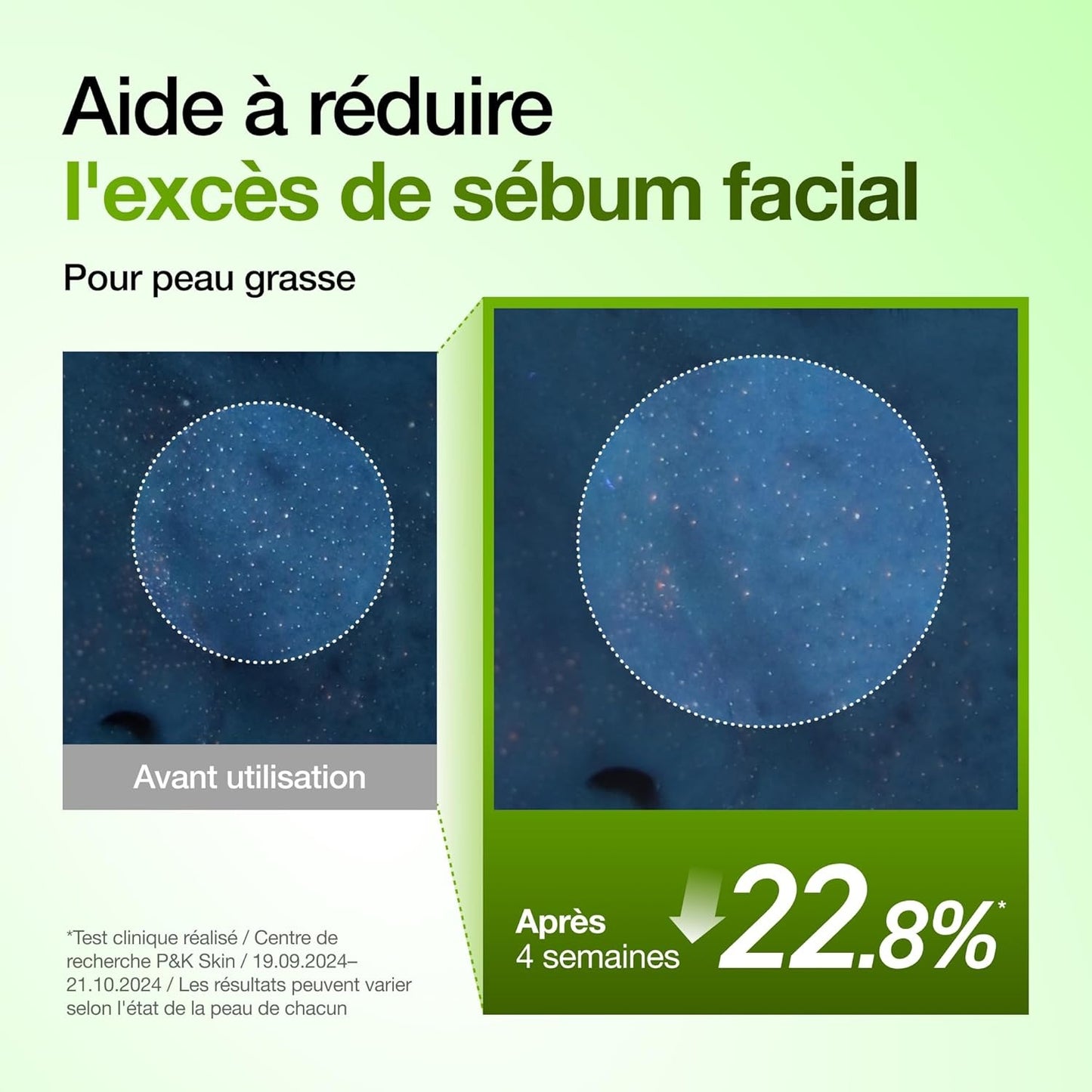 Sérum Apaisant ANUA Acide Azélaïque 10% + Hyaluron – Rougeurs, Acné & Peau Nette