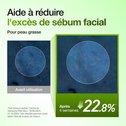 Sérum Apaisant ANUA Acide Azélaïque 10% + Hyaluron – Rougeurs, Acné & Peau Nette