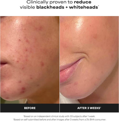 Paula's Choice Skin Perfecting 2% BHA — Lotion Exfoliante à l'Acide Salicylique · 118 ml