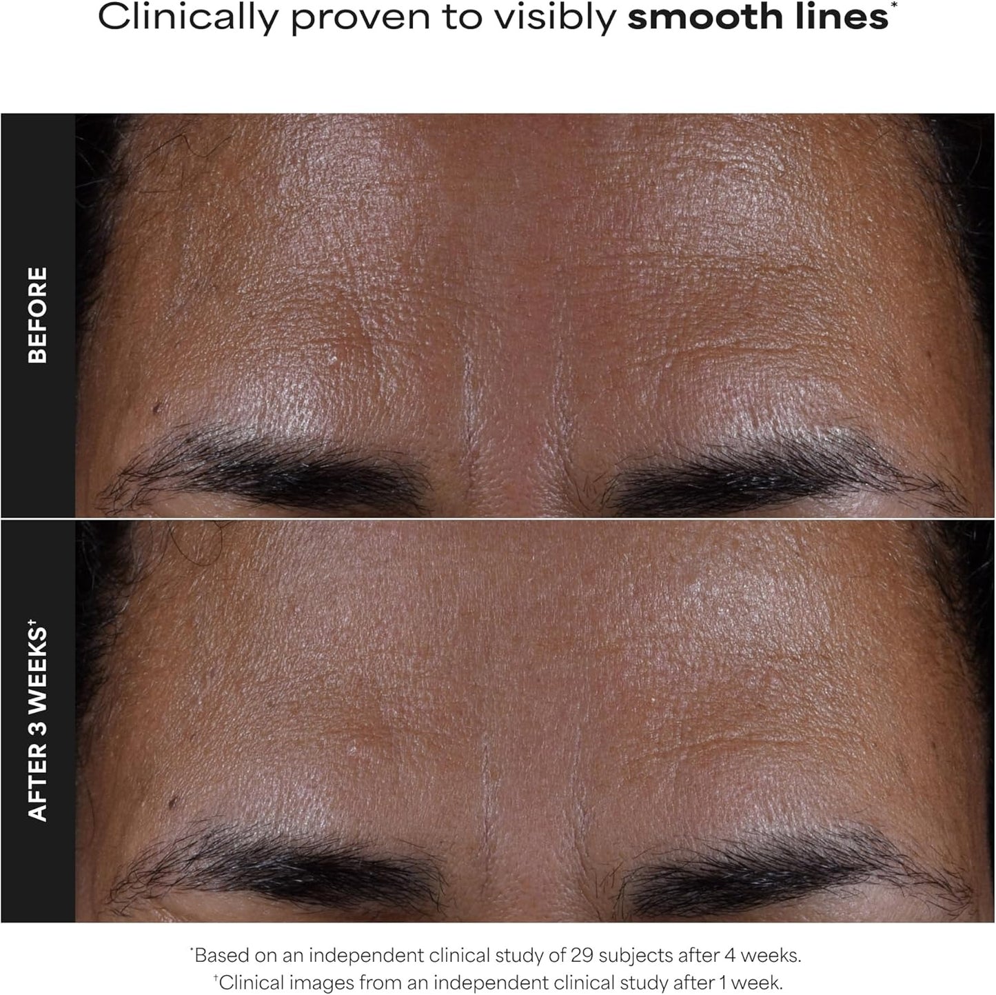 Paula's Choice Skin Perfecting 2% BHA — Lotion Exfoliante à l'Acide Salicylique · 118 ml